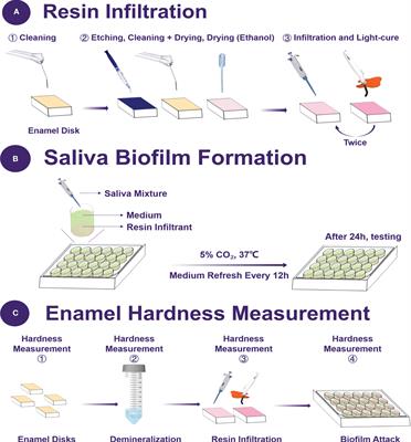 Novel dental resin infiltrant containing smart monomer dodecylmethylaminoethyl methacrylate